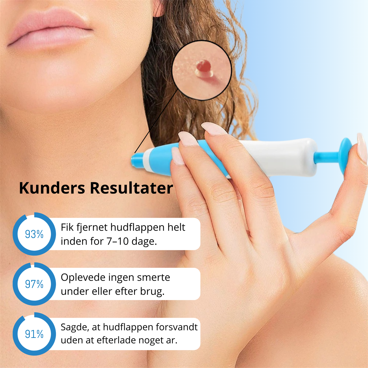 DermaTag™ - Smertfri fjernelse af hudflapper