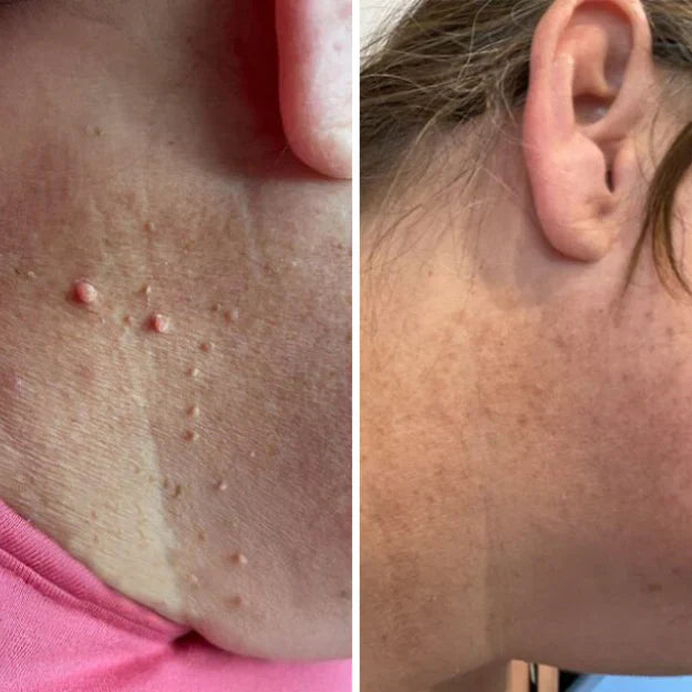 DermaTag — testens vinner