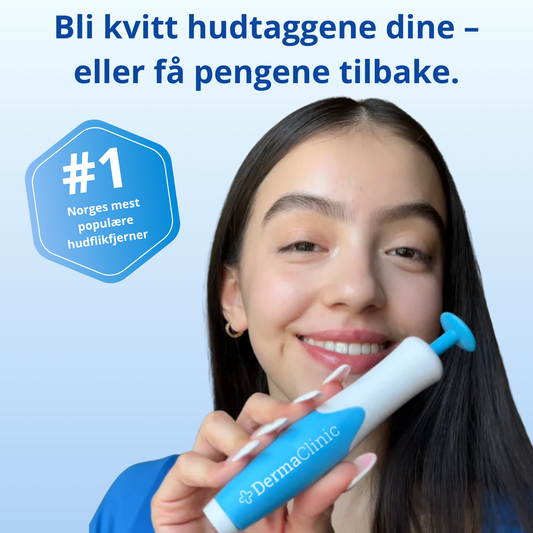 DermaTag™ – Smertfri fjerning av hudtagger