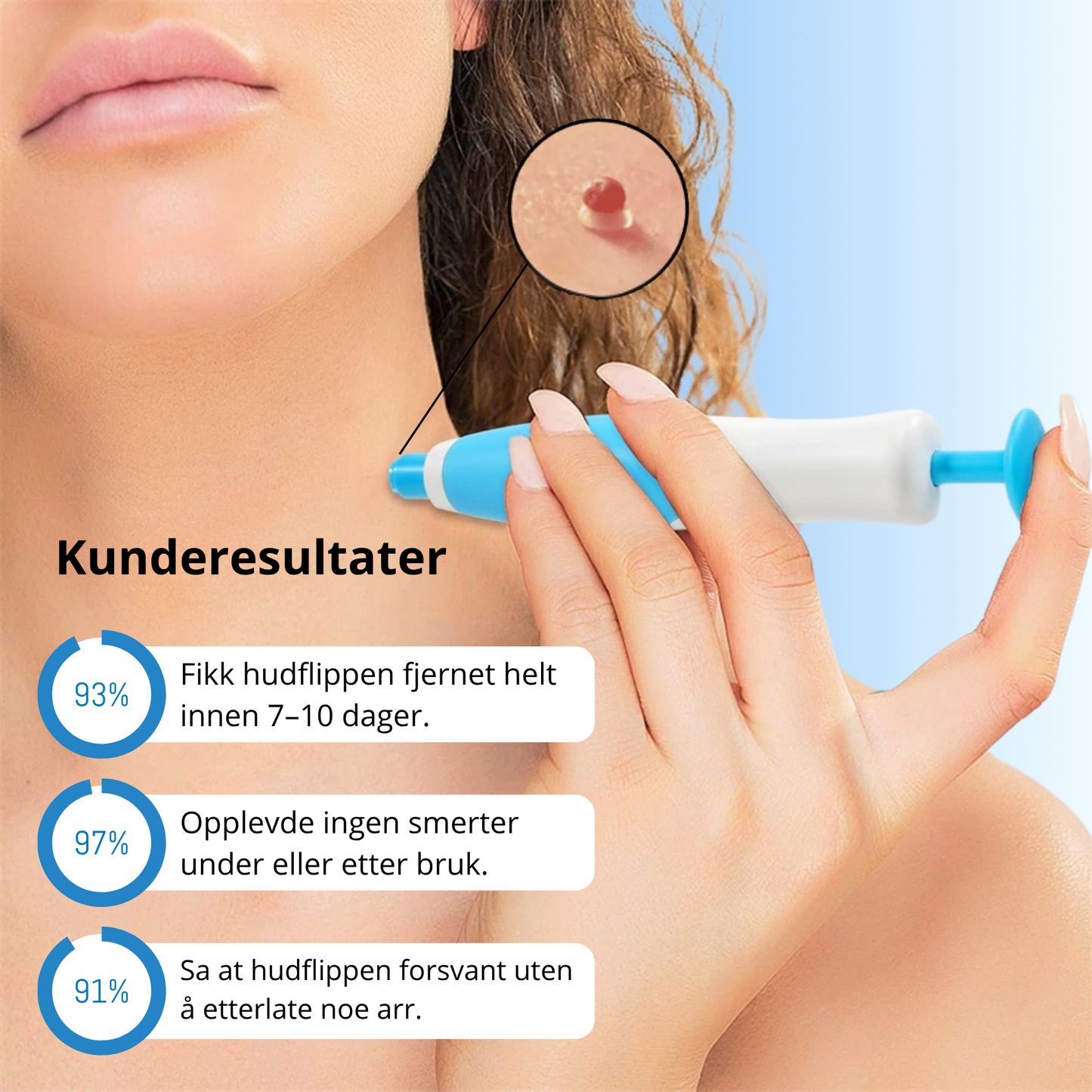 DermaTag™ – Smertfri fjerning av hudtagger