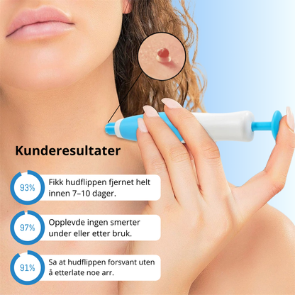 DermaTag™ – Smertfri fjerning av hudtagger