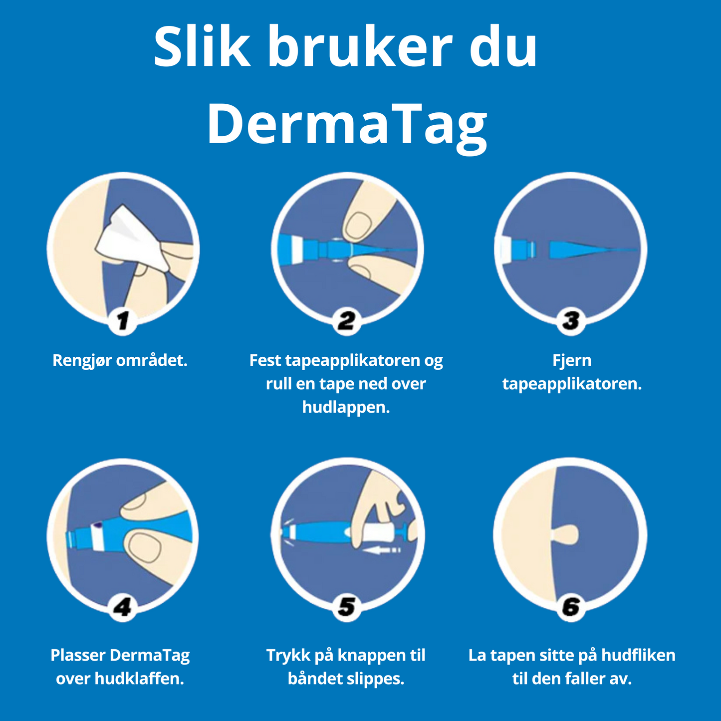 DermaTag™ – Smertfri fjerning av hudtagger