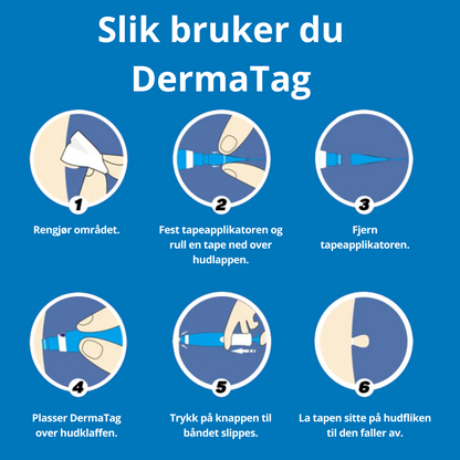 DermaTag™ – Smertfri fjerning av hudtagger